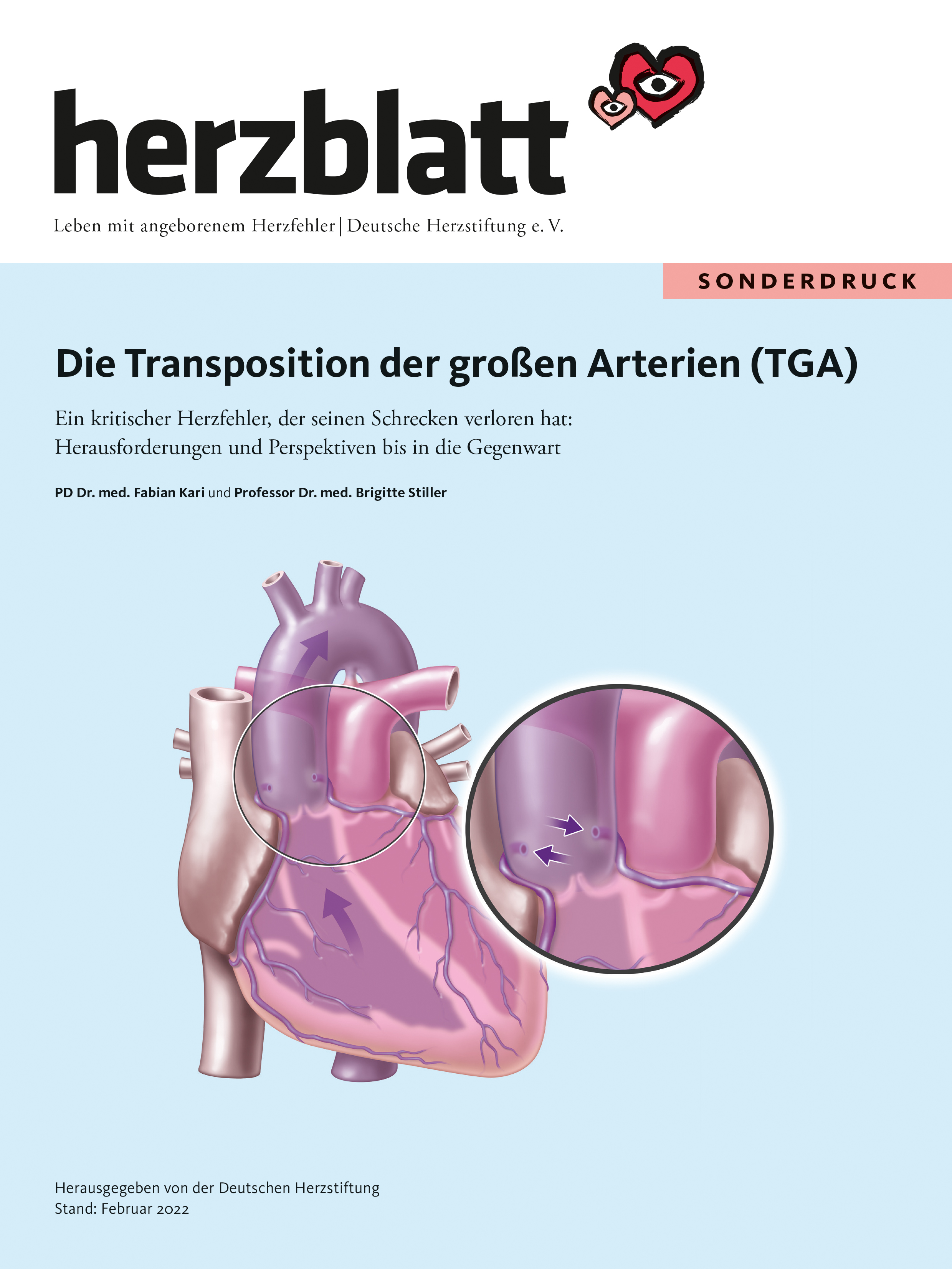 Titelbild Die Transposition der großen Arterien (TGA)