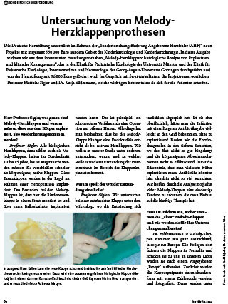 Titelbild des Artikels:Untersuchung von Melody- Herzklappenprothesen
