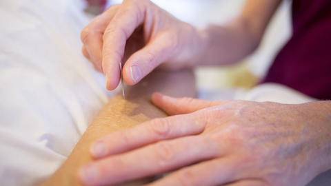 Behandlung Akupunktur