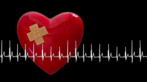 Herz mit Vorhofflimmern