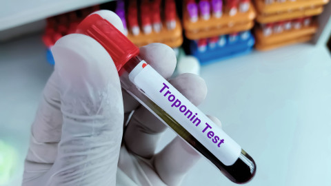 Labor Bluttest Troponin
