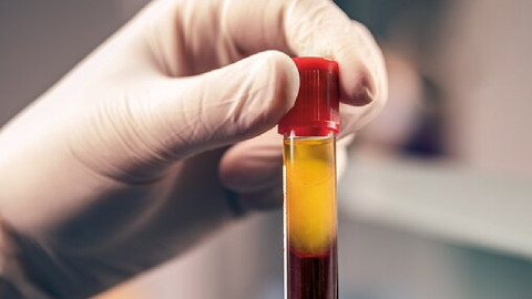 Gewinnung von Plasma aus Blut